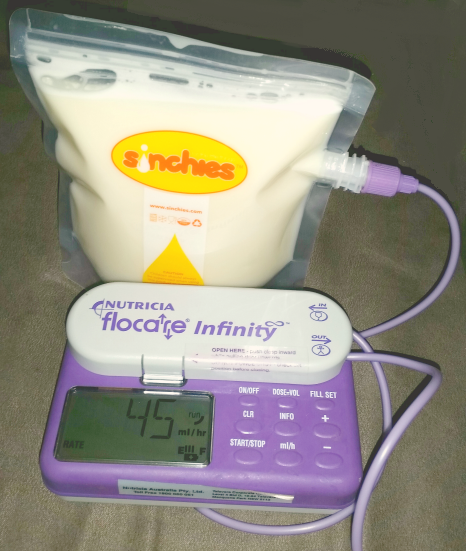 Sinchies infinity feeding pump 3